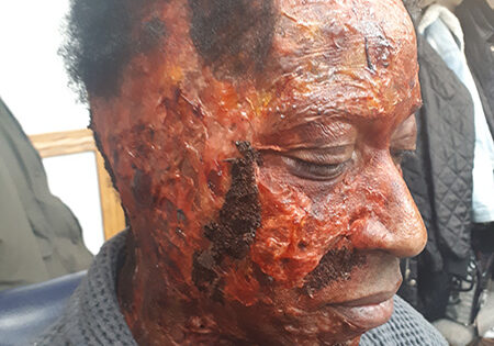 Tales from the Hood - Burn